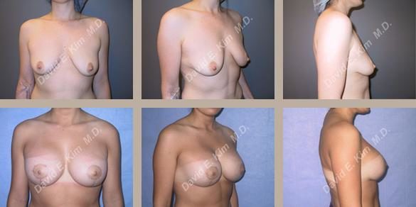 Image of patient post surgery