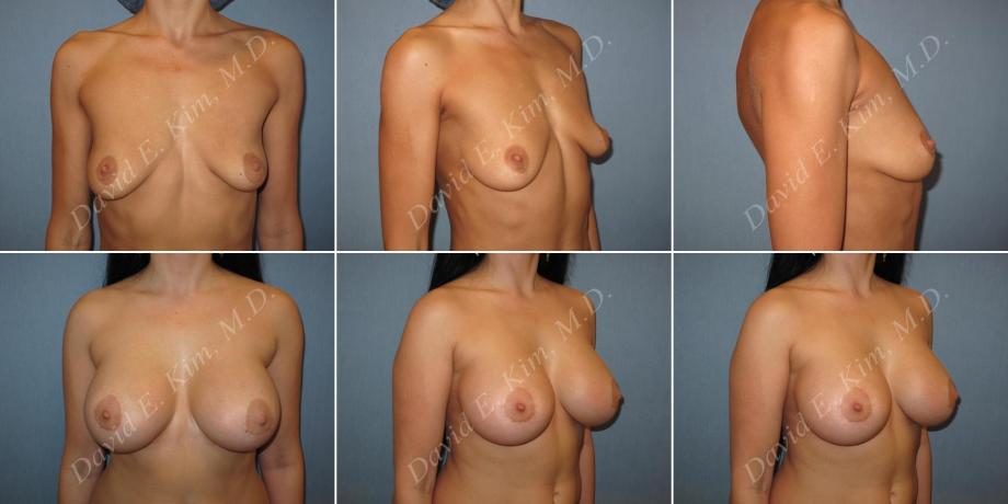 Image of patient post surgery