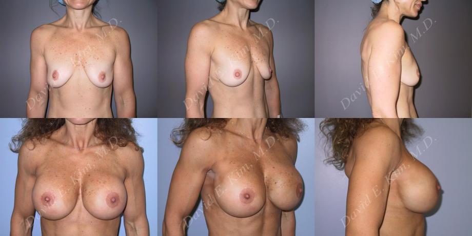 Image of patient post surgery