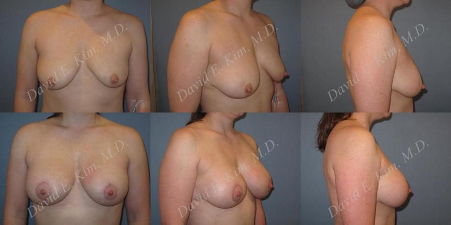Image of patient post surgery