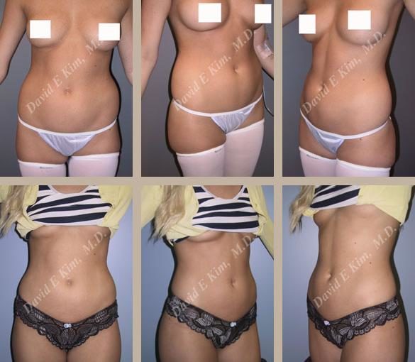 Image of patient post surgery