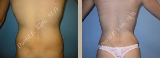 Image of patient post surgery