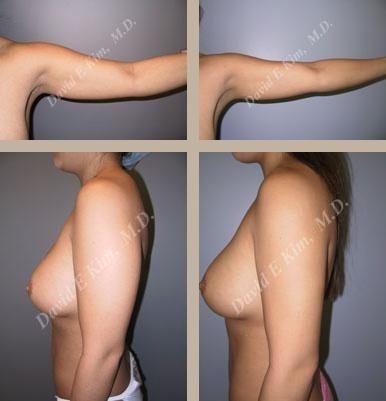Image of patient post surgery