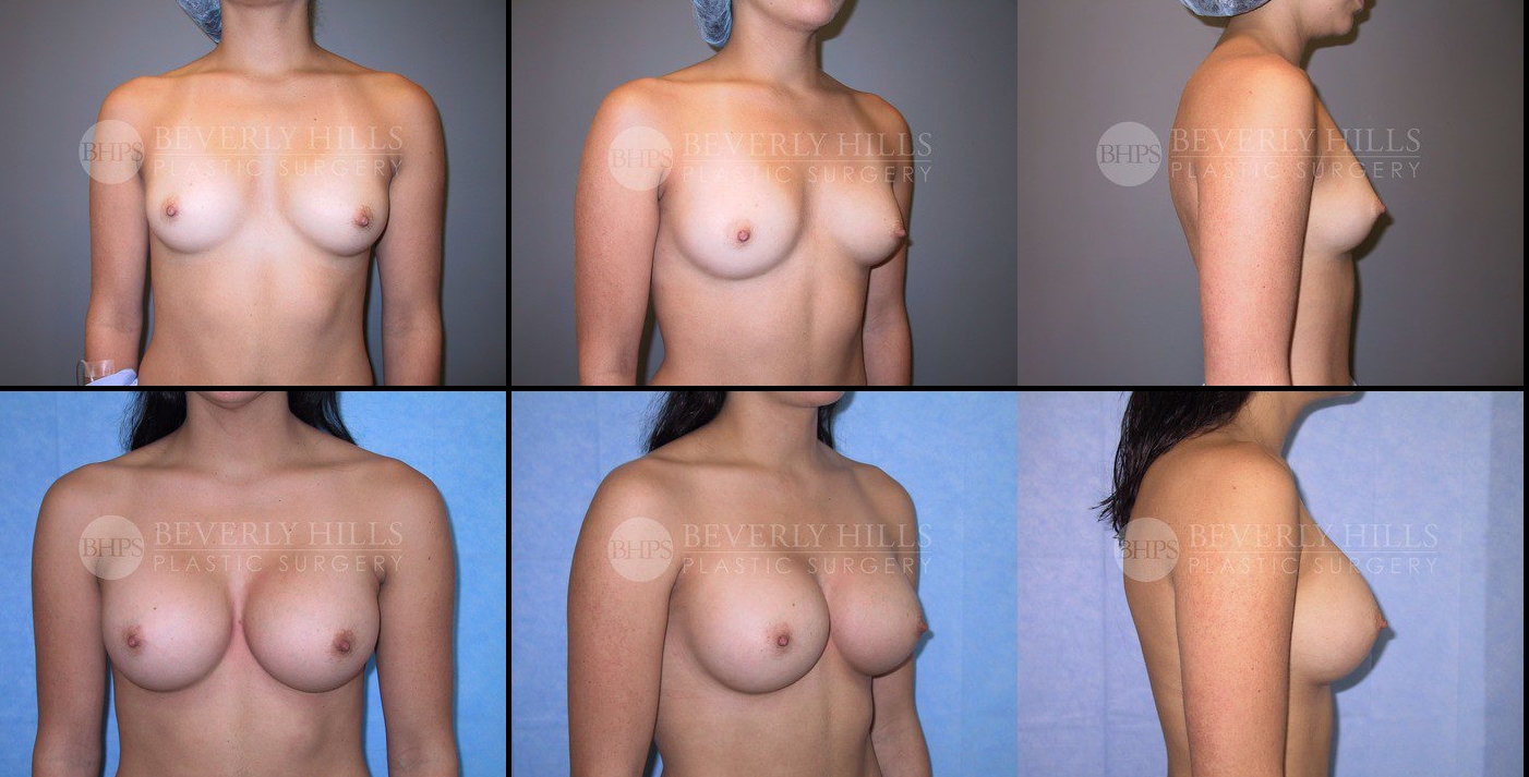 Image of patient post surgery