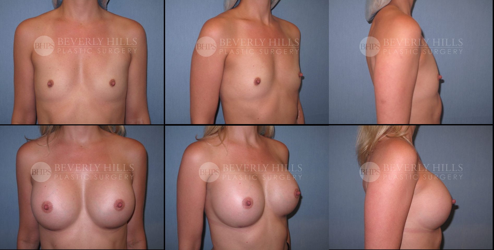 Image of patient post surgery