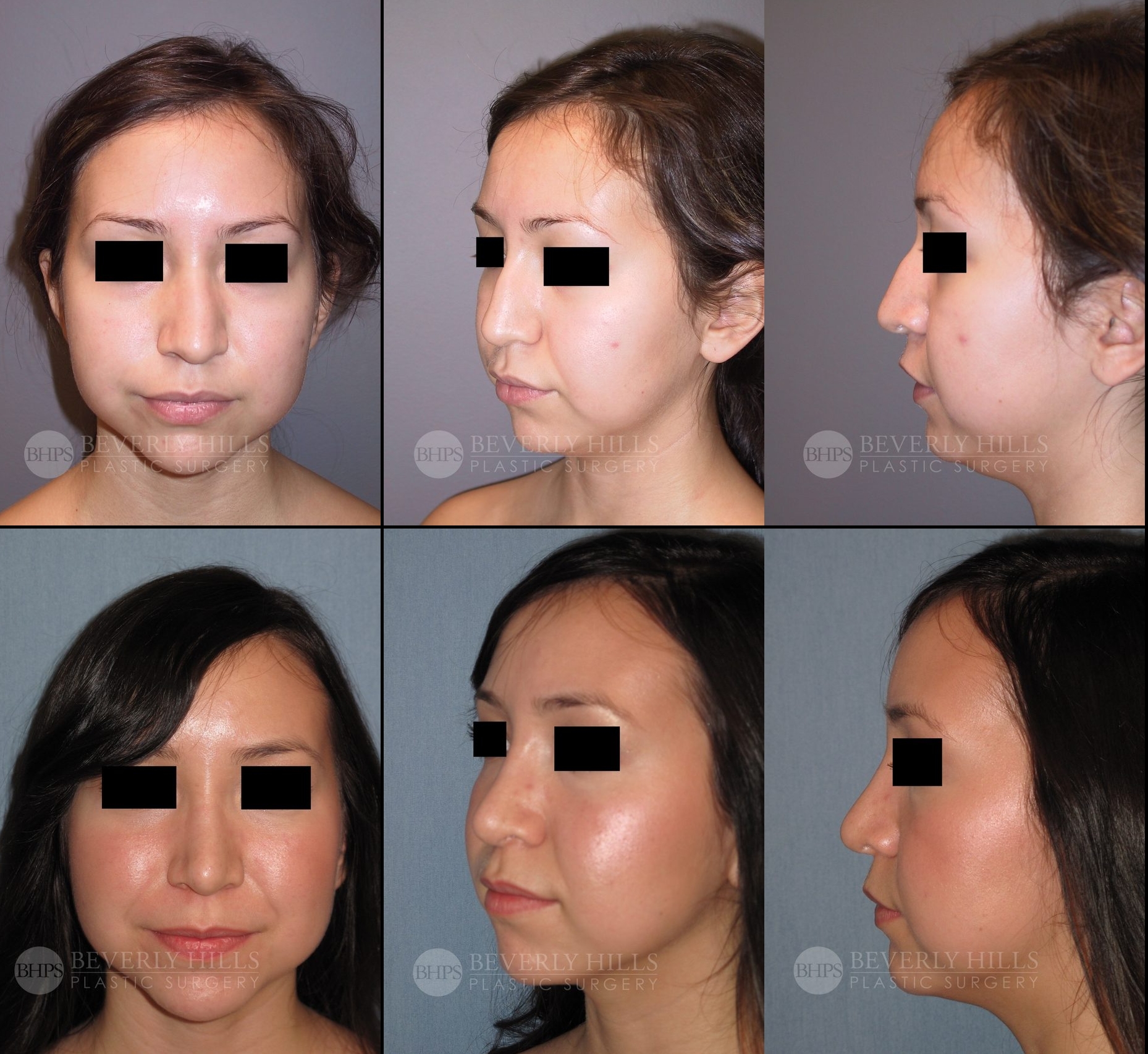 Image of patient post surgery