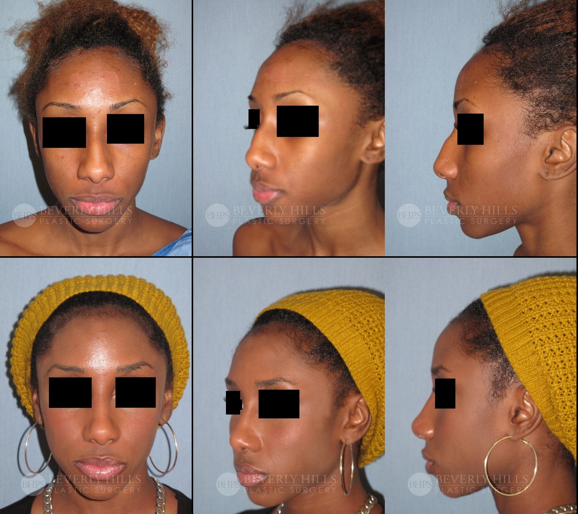 Image of patient post surgery