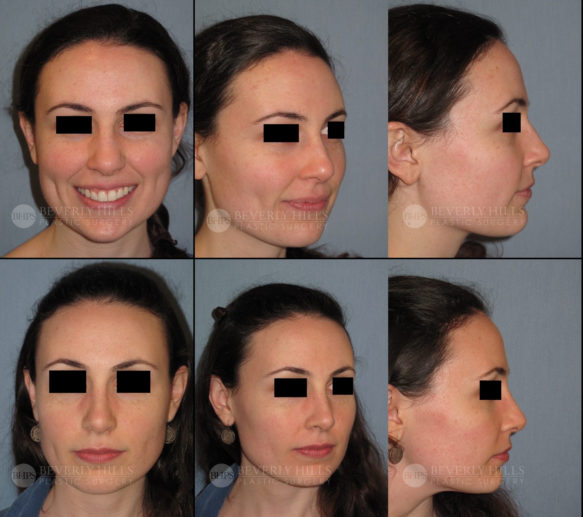 Image of patient post surgery