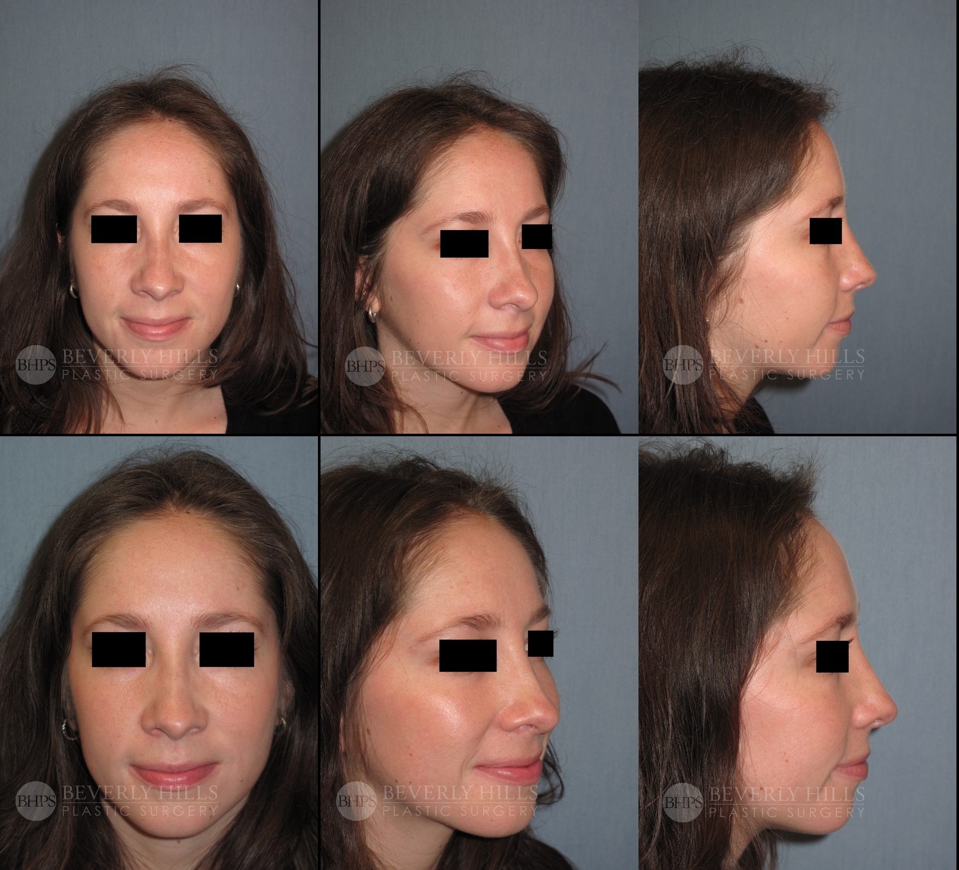 Image of patient post surgery