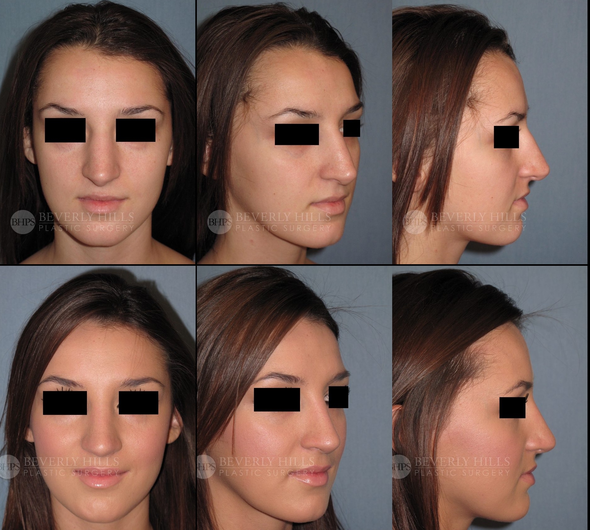 Image of patient post surgery